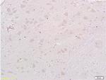 MAP1A Antibody in Immunohistochemistry (Paraffin) (IHC (P))