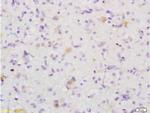 MAP1A Antibody in Immunohistochemistry (Paraffin) (IHC (P))