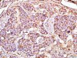 MAP1A Antibody in Immunohistochemistry (Paraffin) (IHC (P))