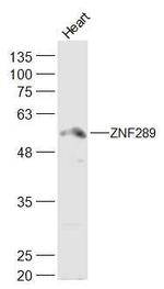 ZNF289/ARFGAP2 Antibody in Western Blot (WB)