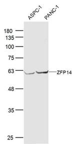 ZFP14 Antibody in Western Blot (WB)