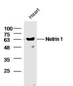 Ntn1/Netrin 1 Antibody in Western Blot (WB)