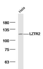 LZTR2 Antibody in Western Blot (WB)