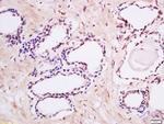 Phospho-MAK (Tyr159) Antibody in Immunohistochemistry (Paraffin) (IHC (P))