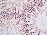 Phospho-MAK (Tyr159) Antibody in Immunohistochemistry (Paraffin) (IHC (P))