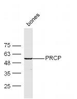 PRCP Antibody in Western Blot (WB)