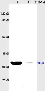 PRDX3/peroxiredoxin 3 Antibody in Western Blot (WB)