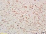 PSAP/PAP Antibody in Immunohistochemistry (Paraffin) (IHC (P))