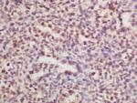 RPLP0 Antibody in Immunohistochemistry (Paraffin) (IHC (P))