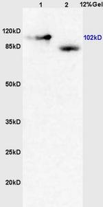 Metabotropic Glutamate Receptor 4/6 Antibody in Western Blot (WB)