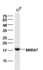 MXRA7 Antibody in Western Blot (WB)