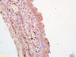 TGM3 Antibody in Immunohistochemistry (Paraffin) (IHC (P))