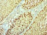 NEK11 Antibody in Immunohistochemistry (Paraffin) (IHC (P))