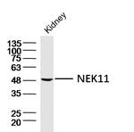 NEK11 Antibody in Western Blot (WB)