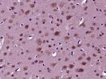 Phospho-NeuroD1 (Ser274) Antibody in Immunohistochemistry (Paraffin) (IHC (P))