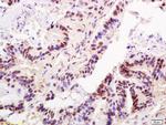 TRF2 Antibody in Immunohistochemistry (Paraffin) (IHC (P))