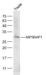 NIPSNAP1 Antibody in Western Blot (WB)