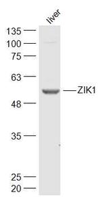ZIK1 Antibody in Western Blot (WB)
