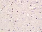 PLAUR Antibody in Immunohistochemistry (Paraffin) (IHC (P))