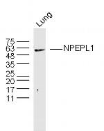 NPEPL1 Antibody in Western Blot (WB)