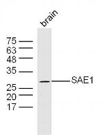 SAE1 Antibody in Western Blot (WB)