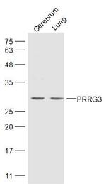 PRRG3 Antibody in Western Blot (WB)