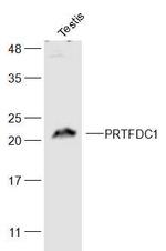 PRTFDC1 Antibody in Western Blot (WB)