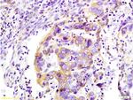 WNK3 protein Antibody in Immunohistochemistry (Paraffin) (IHC (P))