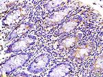 WNK3 protein Antibody in Immunohistochemistry (Paraffin) (IHC (P))