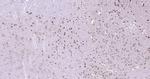 PSMD14 Antibody in Immunohistochemistry (Paraffin) (IHC (P))