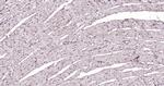 PSMD14 Antibody in Immunohistochemistry (Paraffin) (IHC (P))