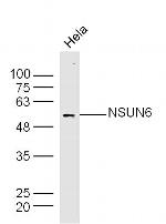 NSUN6 Antibody in Western Blot (WB)