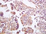 WNT5A Antibody in Immunohistochemistry (Paraffin) (IHC (P))