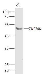 ZNF596 Antibody in Western Blot (WB)