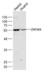 ZNF599 Antibody in Western Blot (WB)