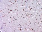 ZNF502 Antibody in Immunohistochemistry (Paraffin) (IHC (P))