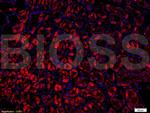 VPS18 Antibody in Immunohistochemistry (Paraffin) (IHC (P))