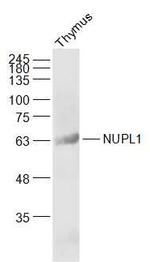 NUPL1 Antibody in Western Blot (WB)