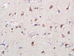 PSMG1 Antibody in Immunohistochemistry (Paraffin) (IHC (P))
