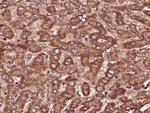 PTPD1 Antibody in Immunohistochemistry (Paraffin) (IHC (P))