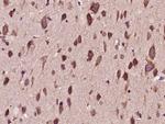 PTPD1 Antibody in Immunohistochemistry (Paraffin) (IHC (P))