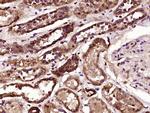 PTPD1 Antibody in Immunohistochemistry (Paraffin) (IHC (P))