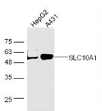 NTCP/SLC10A1 Antibody in Western Blot (WB)