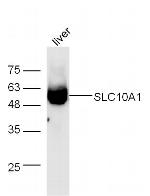 NTCP/SLC10A1 Antibody in Western Blot (WB)