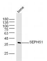SEPHS1 Antibody in Western Blot (WB)