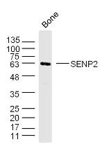 SENP2 Antibody in Western Blot (WB)