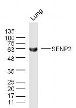 SENP2 Antibody in Western Blot (WB)