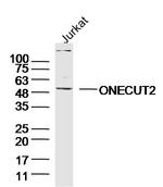 ONECUT2 Antibody in Western Blot (WB)