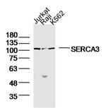SERCA3 Antibody in Western Blot (WB)