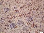 LAMP-1 Antibody in Immunohistochemistry (Paraffin) (IHC (P))